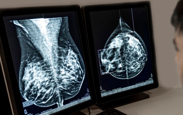 La_comision_europea_aprueba_kisqali_de_Novartis_para_pacientes_con_cancer_de_mama_localizado_HR_HER2_con_riesgo_de_recaida.jpg