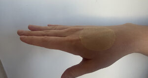 Desarrollo de un vendaje innovador que acelera la cicatrización y previene infecciones