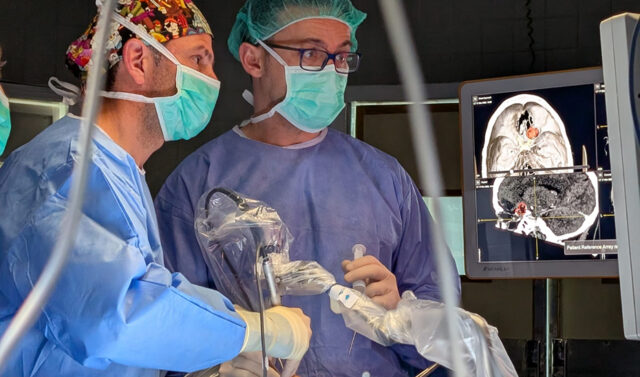 Innovadora_tecnica_de_cirugia_cerebral_sin_aperturas_craneales_se_implementa_en_Andalucia.jpg