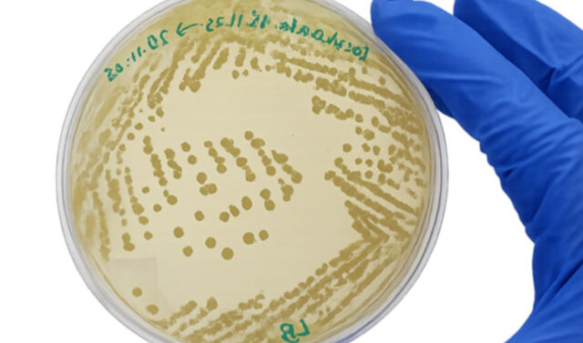 Investigadores_andaluces_logran_bacterias_que_eliminan_ibuprofeno_en_solo_tres_dias_de_suelos_agricolas_contaminados.jpg