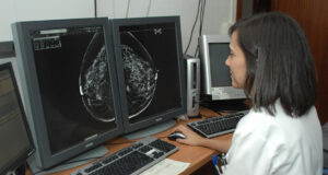 La Junta de Andalucía licita la contratación de unidades móviles para el cribado de cáncer de mama en zonas rurales
